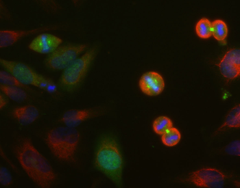 Aurora A/B/C kinase Antibody