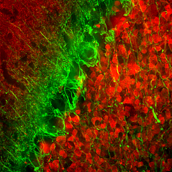 α-Internexin/NF 66 Antibody