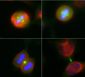 Aurora A/B Kinase Antibody