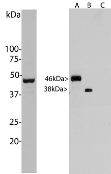 Aurora A/B Kinase Antibody