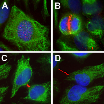 Aurora B Kinase Antibody