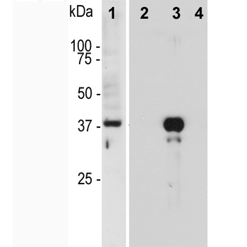 Aurora B Kinase Antibody