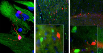 Calretinin Antibody
