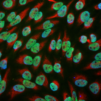 EWSR1 Antibody