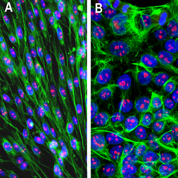 Fibrillarin Antibody