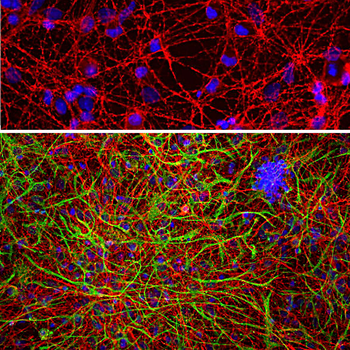 GAP43 (IgG) Antibody