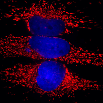 HSP60 (Heat Shock Protein 60) Antibody