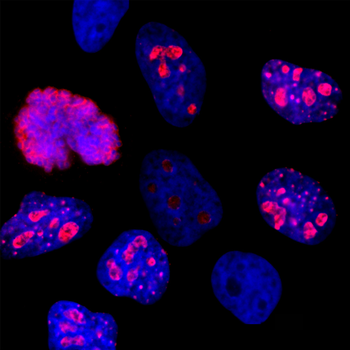 Ki67 Antibody