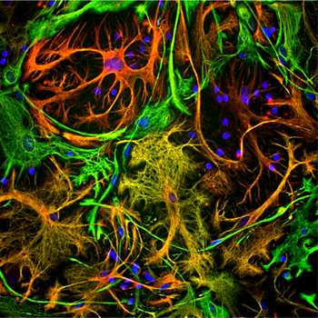 Vimentin Antibody