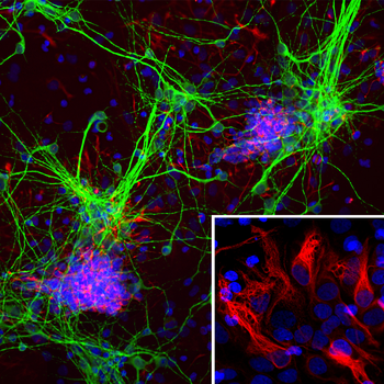Nestin Antibody
