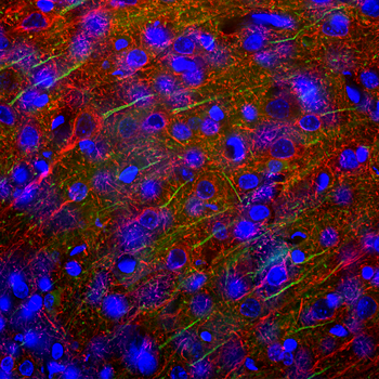 Ankyrin 3 Antibody