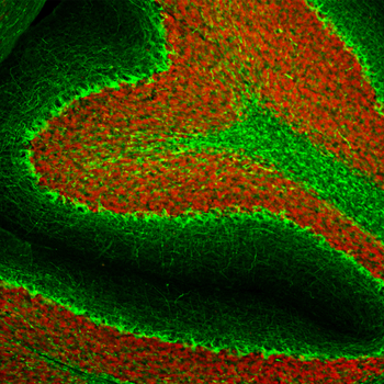Neurofilament NF-H Antibody