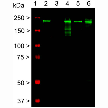 Neurofilament NF-H Antibody