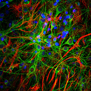 Tau Antibody