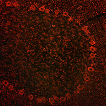 ADAM15 Antibody