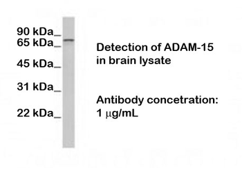 ADAM15 Antibody