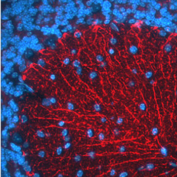 BACE1 Antibody