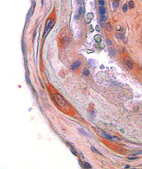 CSF1 (Colony Stimulating Factor 1) Antibody