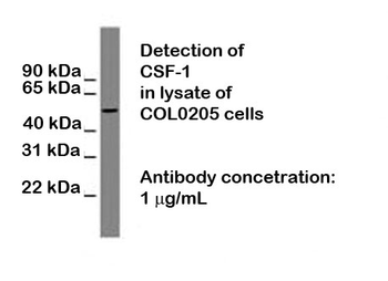 CSF1 (Colony Stimulating Factor 1) Antibody