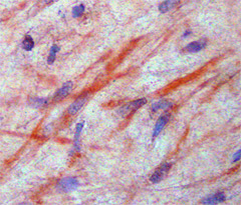 CSF1 (Colony Stimulating Factor 1) Antibody