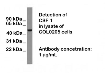 CSF1 (Colony Stimulating Factor 1) Antibody