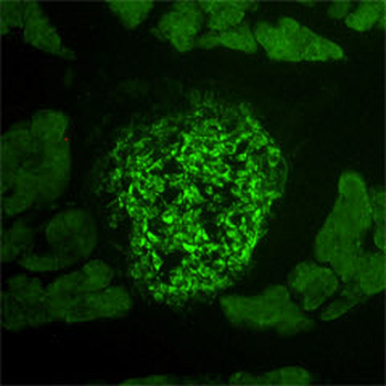 IGF1R (Insulin-Like Growth Factor Receptor 1) Antibody