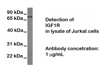 IGF1R (Insulin-Like Growth Factor Receptor 1) Antibody