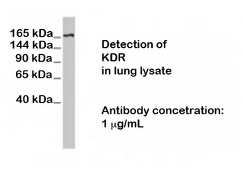 KDR (Kinase Insert Domain Receptor) Antibody