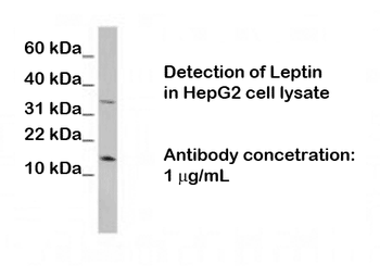 Leptin Antibody
