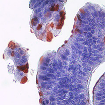 MMP1 (Matrix Mellatopeptidase 1), N terminal region Antibody
