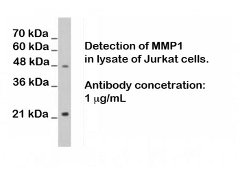MMP1 (Matrix Mellatopeptidase 1), N terminal region Antibody