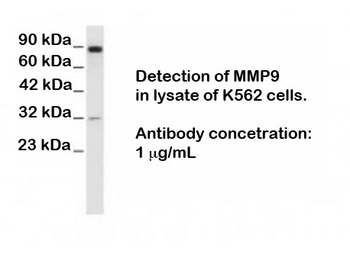 MMP9 (Matrix Mellatopeptidase 9), N terminal region Antibody