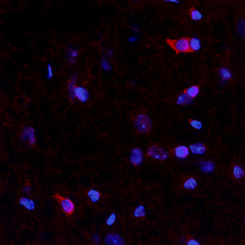 Netrin-4 (NTN4) Antibody