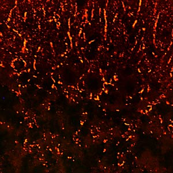 Synaptophysin (SYP) Antibody