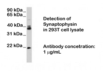 Synaptophysin (SYP) Antibody