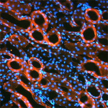 Transforming Growth Factor (TGF) beta 1, middle region Antibody