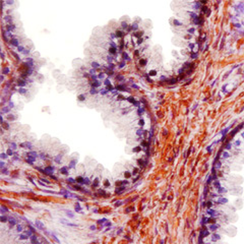 Transforming Growth Factor (TGF) beta 1, middle region Antibody