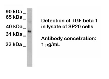 Transforming Growth Factor (TGF) beta 1, middle region Antibody