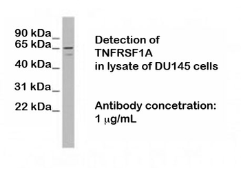 TNFRSF1 (Tumor Necrosis Factor Receptor Superfamily, Member 1A), N terminal region Antibody