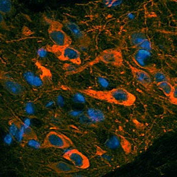 Tyrosine Hydroxylase Antibody