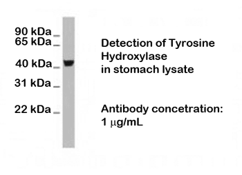 Tyrosine Hydroxylase Antibody