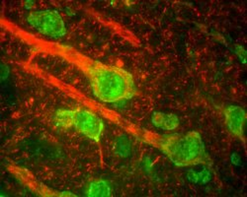 Neurofilament NF-M Antibody