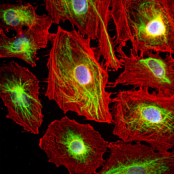 Vimentin Antibody