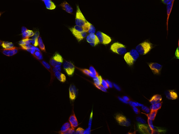 Nestin Antibody