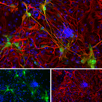 Galectin-3 Rabbit Polyclonal Antibody