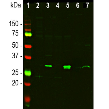 Galectin-3 Rabbit Polyclonal Antibody