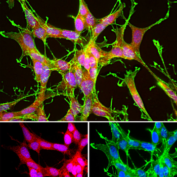 DJ1/Park7 Polyclonal Rabbit Antibody