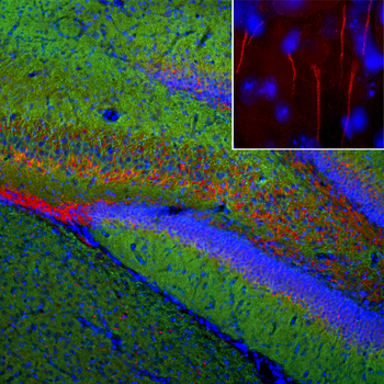 Ankyrin 3 Antibody