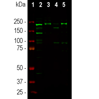Ankyrin 3 Antibody