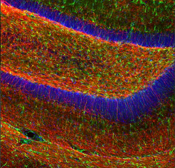 Myelin Basic Protein (MBP) Antibody